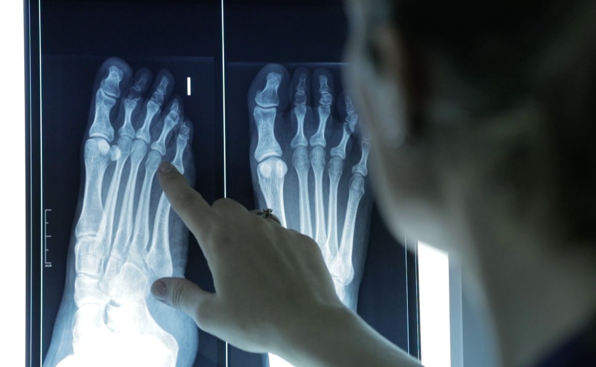 podologos-problemas-pies-deformidades-huesos-010426