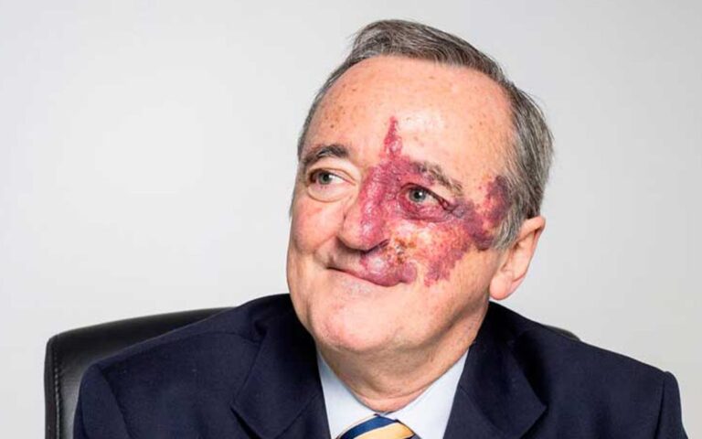 retiran-articulo-barbacid-cancer-pancreas