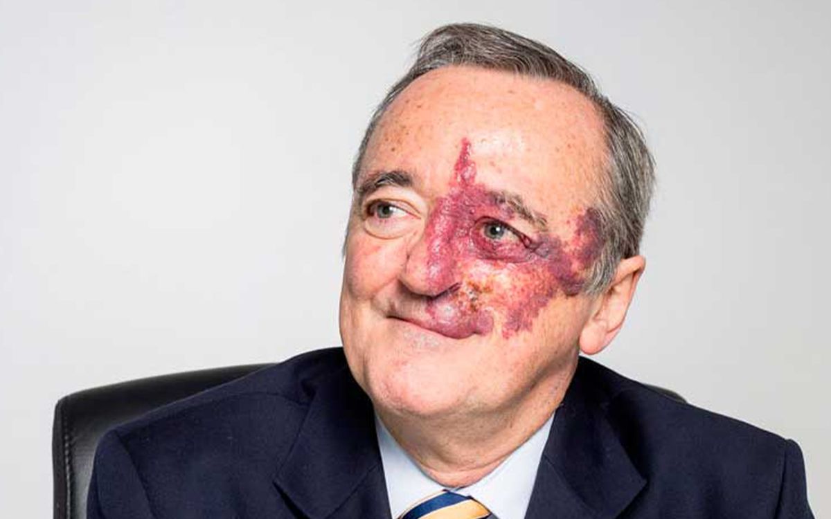 retiran-articulo-barbacid-cancer-pancreas